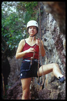 Jamie Ferguson showing off her bug bites